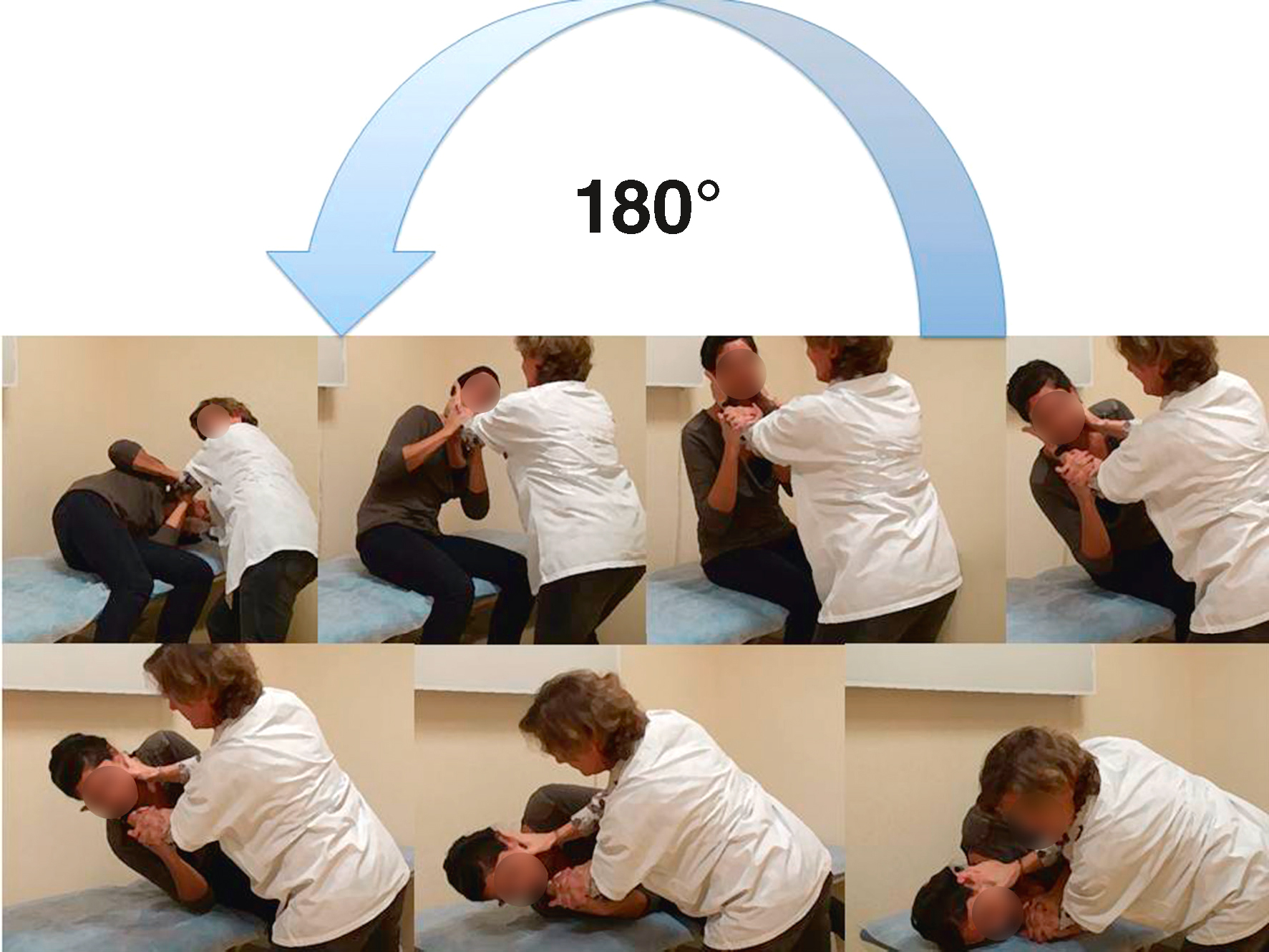La manœuvre de Semont est une technique de repositionnement des otolithes dans l'oreille interne pour traiter le VPPB, réalisée en plusieurs étapes rapides pour réduire les vertiges.