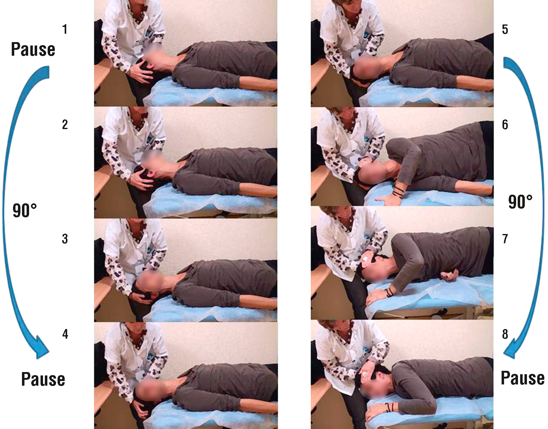 La manœuvre d'Epley déplace les otolithes hors des canaux semi-circulaires par des mouvements contrôlés, traitant efficacement le VPPB et réduisant les vertiges.