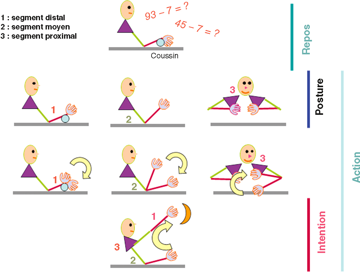 L'image illustre les manœuvres pour différencier les tremblements de repos, postural et intentionnel en fonction de la posture ou du mouvement, facilitant le diagnostic.