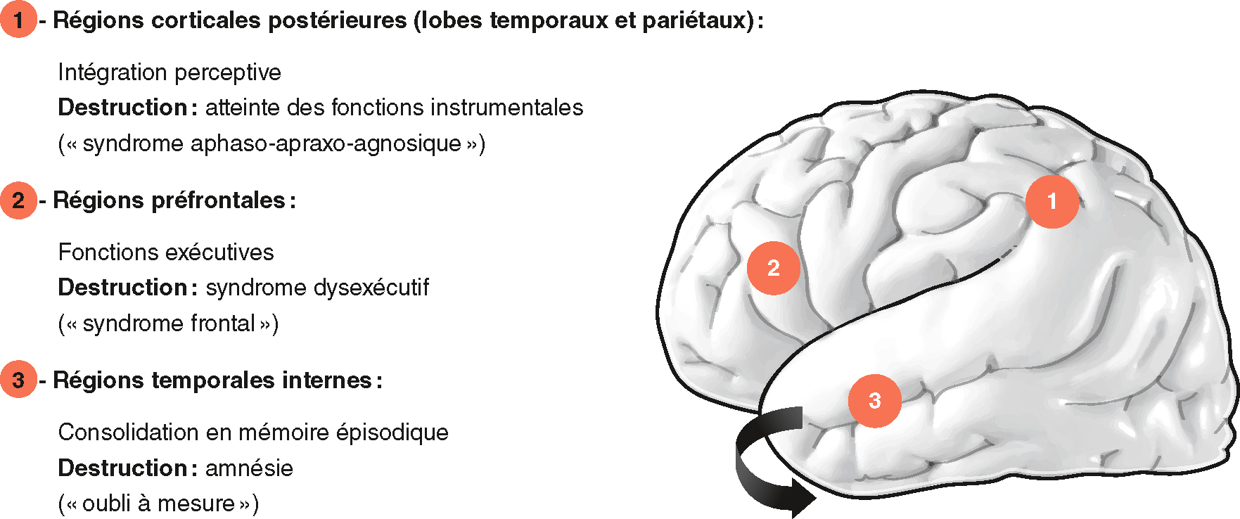 Diagram illustrating the brain's intellectual functions: posterior cortical regions (perception), prefrontal regions (executive functions), and temporal regions (episodic memory).