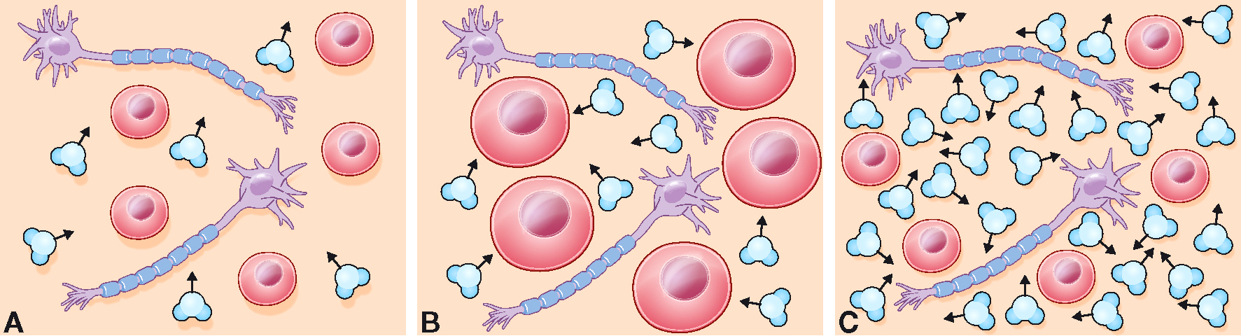 L'image montre trois diagrammes de diffusion des molécules d'eau dans le cerveau, avec des variations indiquant l'influence de l'inflammation et de l'œdème cérébral sur cette diffusion.