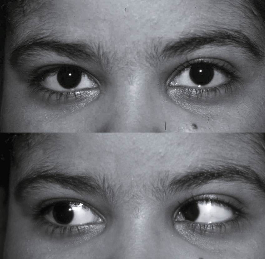 Vue rapprochée des yeux : iris, pupille, sclère, vaisseaux sanguins et cornée. Essentiel pour comprendre la fonction oculaire et maintenir une vision claire.