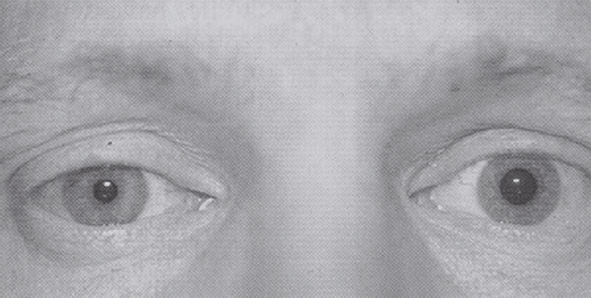 L'image présente de près deux yeux humains, mettant en évidence les pupilles, l'iris, la sclère et la cornée. Elle souligne l'importance de chaque structure pour la vision.