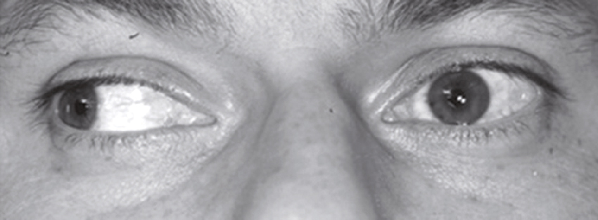 L'image montre deux yeux humains en gros plan, mettant en évidence les pupilles, l'iris, la sclère et la cornée. Elle illustre l'importance de chaque structure pour la vision.