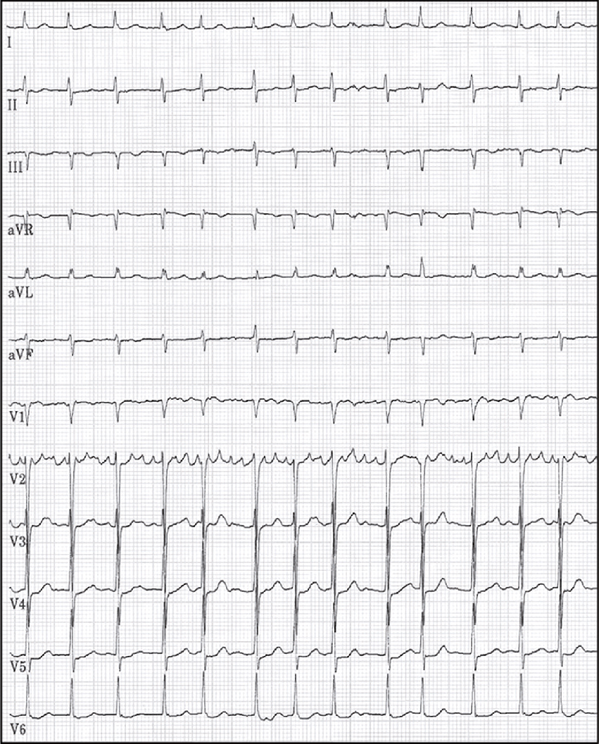 L'image montre un ECG avec plusieurs dérivations pour enregistrer l'activité électrique du cœur. Il permet de surveiller le rythme cardiaque, la fréquence et détecter des anomalies.
