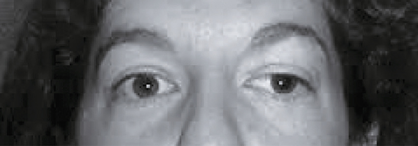 L'image en noir et blanc montre deux yeux humains détaillés. On observe iris, pupille, sclère et paupières, essentiels pour la vision et la protection oculaire.