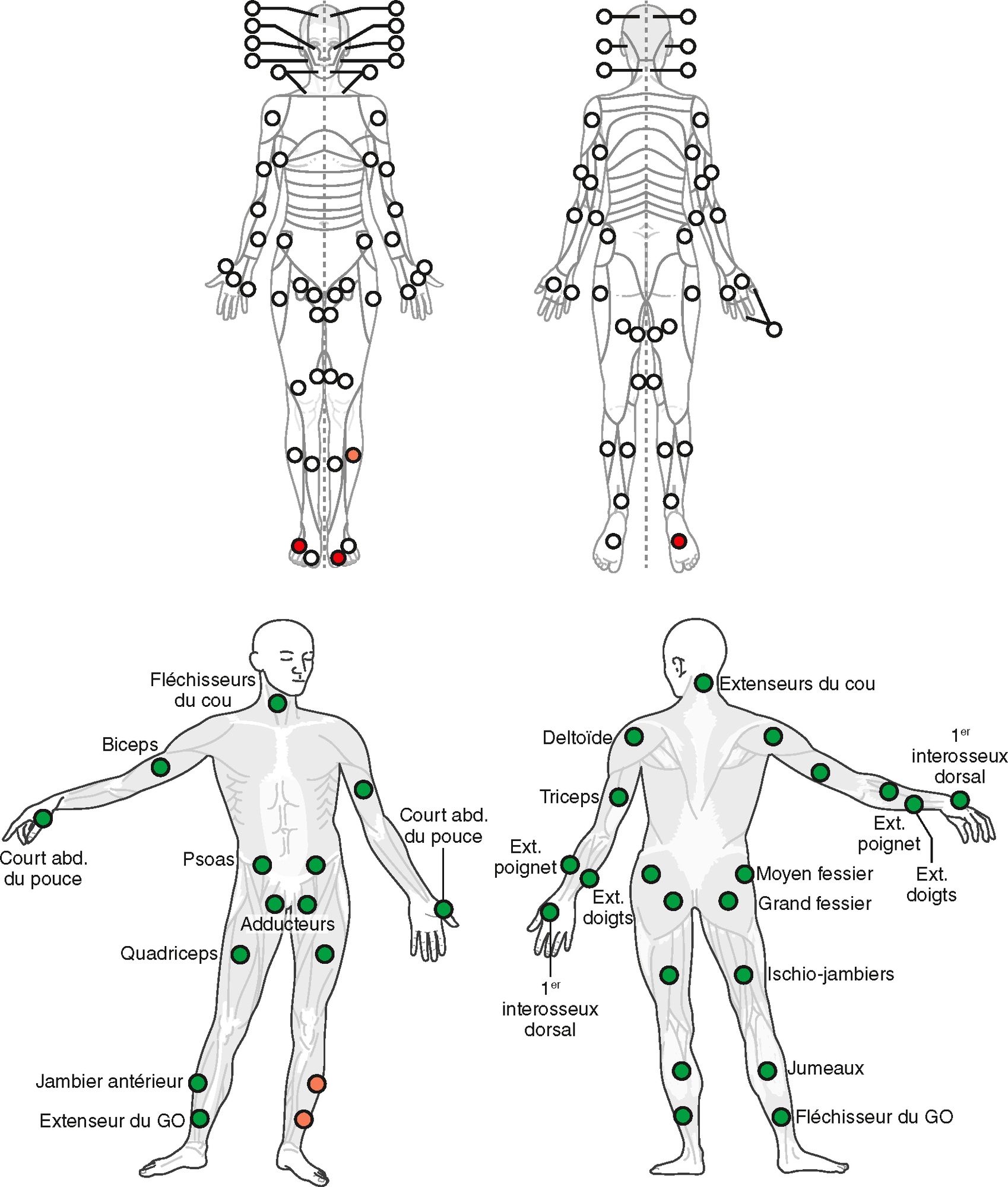 L'image montre un scanner cérébral révélant matière grise, matière blanche et ventricules sombres. Utilisé pour détecter tumeurs, hémorragies ou anomalies cérébrales.