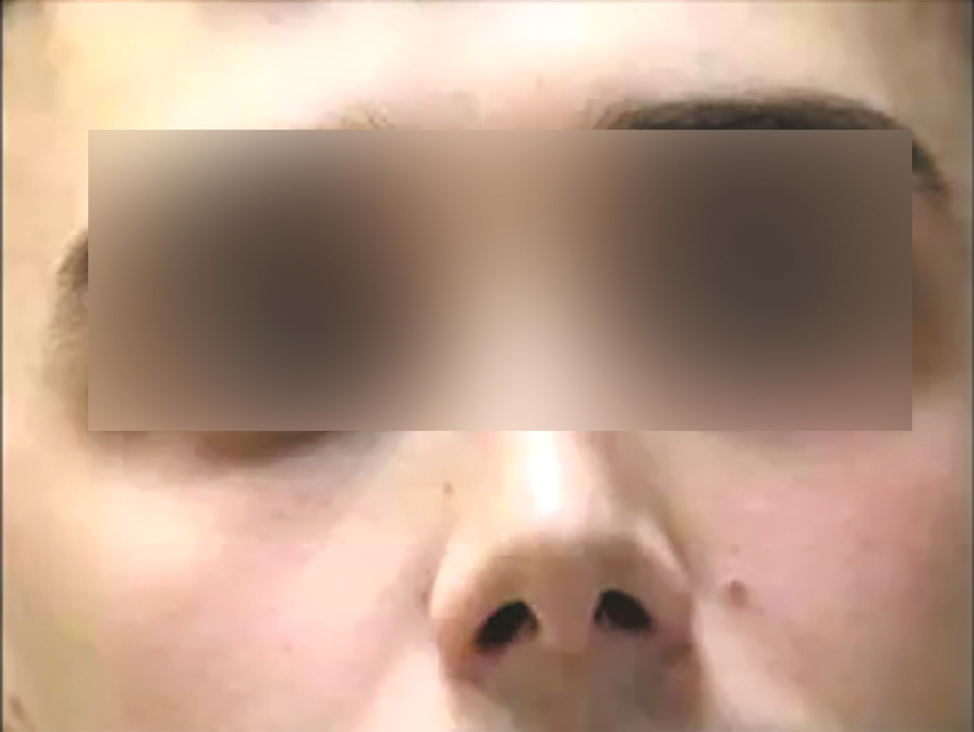 L'image montre un visage humain en gros plan, avec des yeux ouverts, un nez centré, une bouche fermée et des oreilles visibles. Elle met en valeur les traits et expressions du visage.